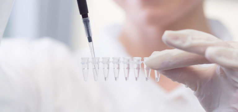 Close-up of female technician with multipipette and in genetic laboratory doing PCR research. Young woman is genetics scientist and she loads saliva samples for DNA amplification